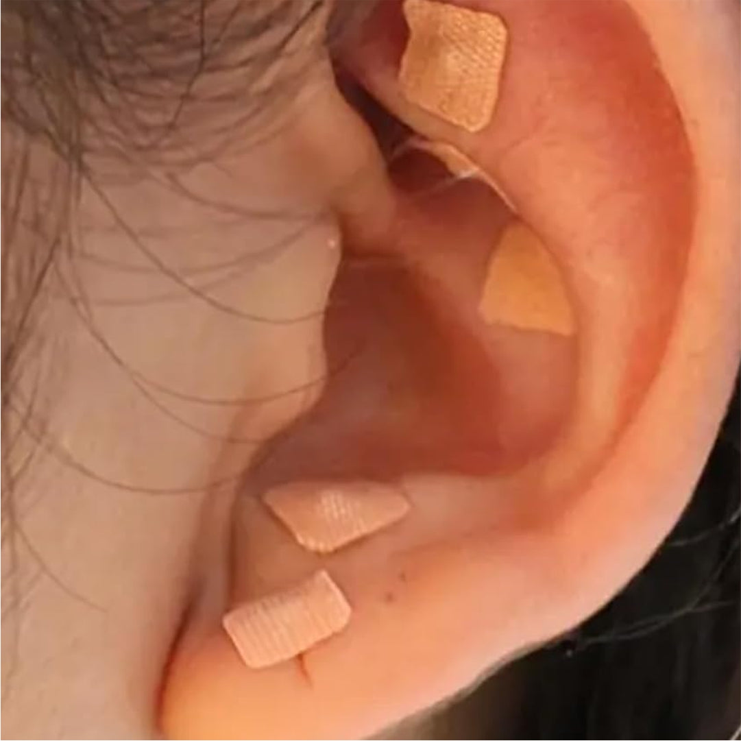 Acupressure Ear Seeds